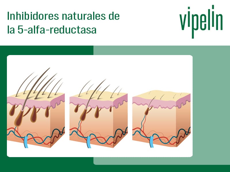 cómo inhibir la 5 alfa reductasa. Inhibidores naturales de la 5 alfa reductasa como alternativas al finas y al Dutas
