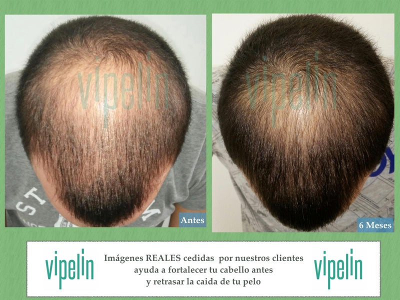 Caso 1 funciona vipelin