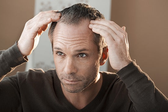 ¿Qué tipos de alopecia existen? ¿Dónde puede ayudar Vipelín?