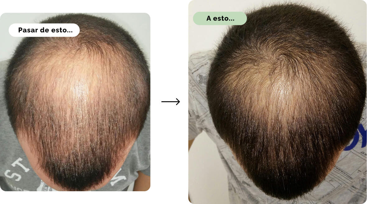 Antes y despues Vipelin Forte