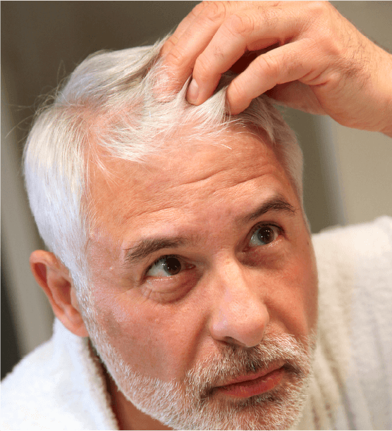 Beneficios del ácido hialurónico para el cabello.