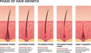 Crecimiento normal del pelo