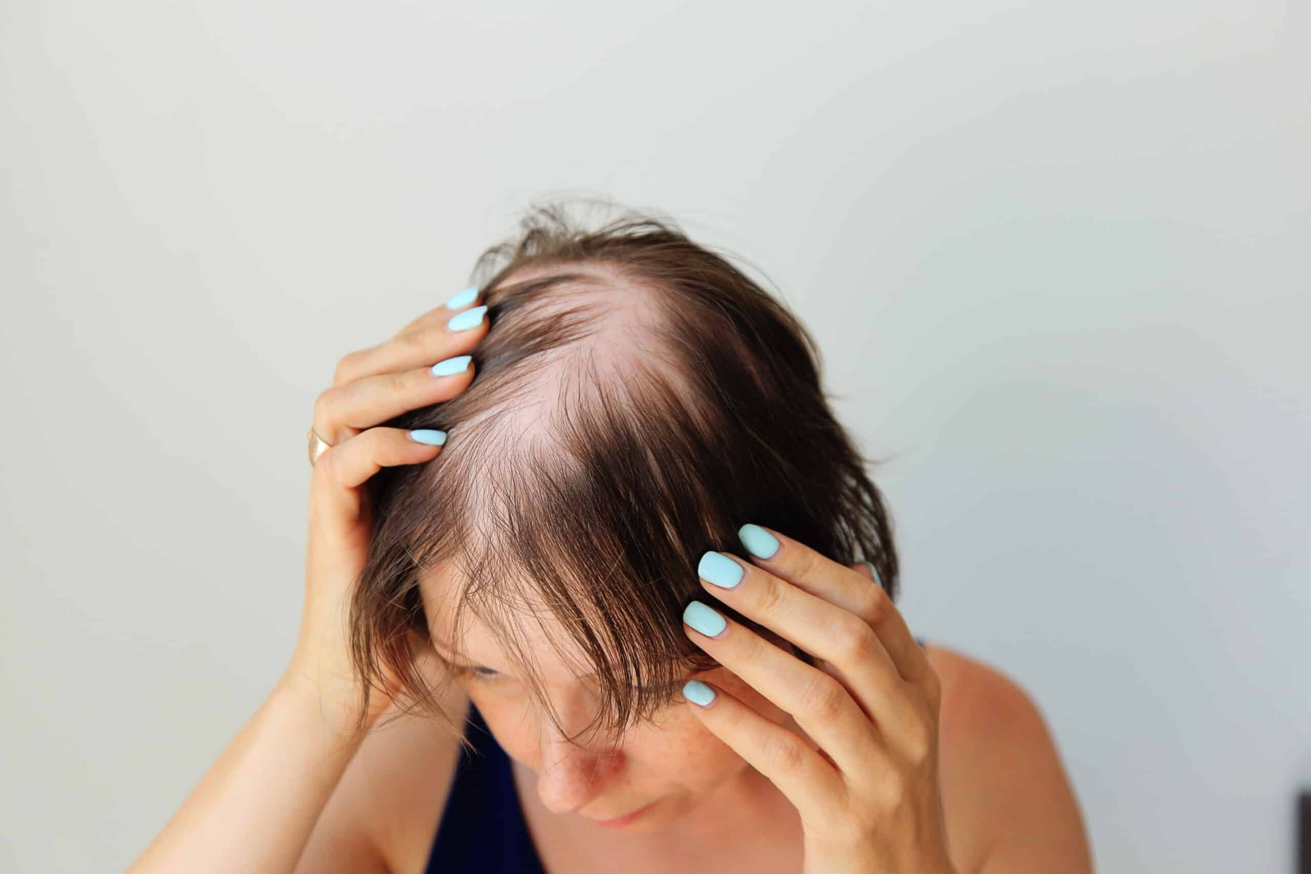 El uso de la loción en mujeres ayuda a cuidar el pelo