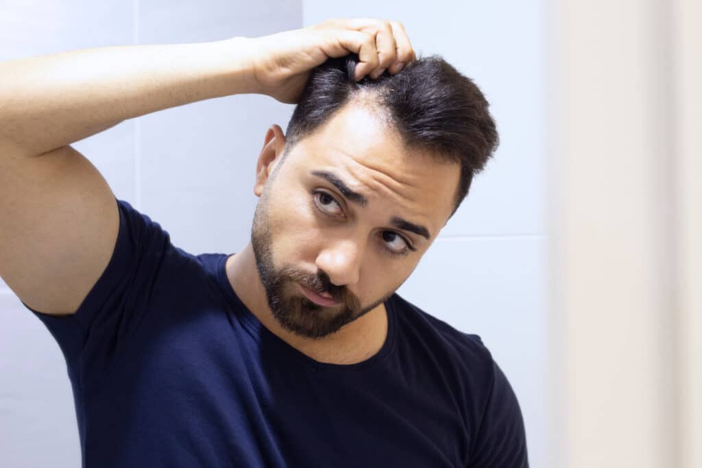 Cuidar el pelo en hombres con alopecia