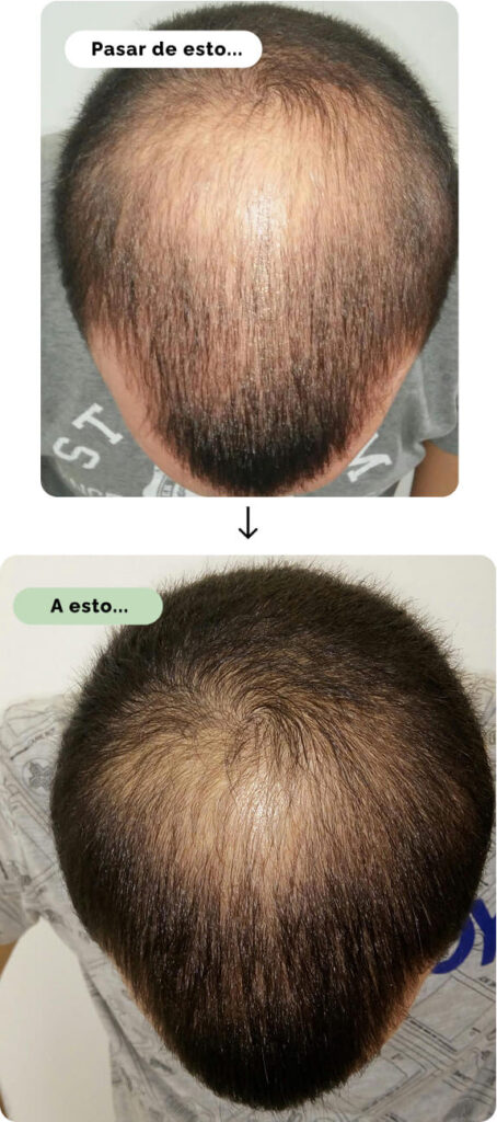 Antes y despues vipelin forte man